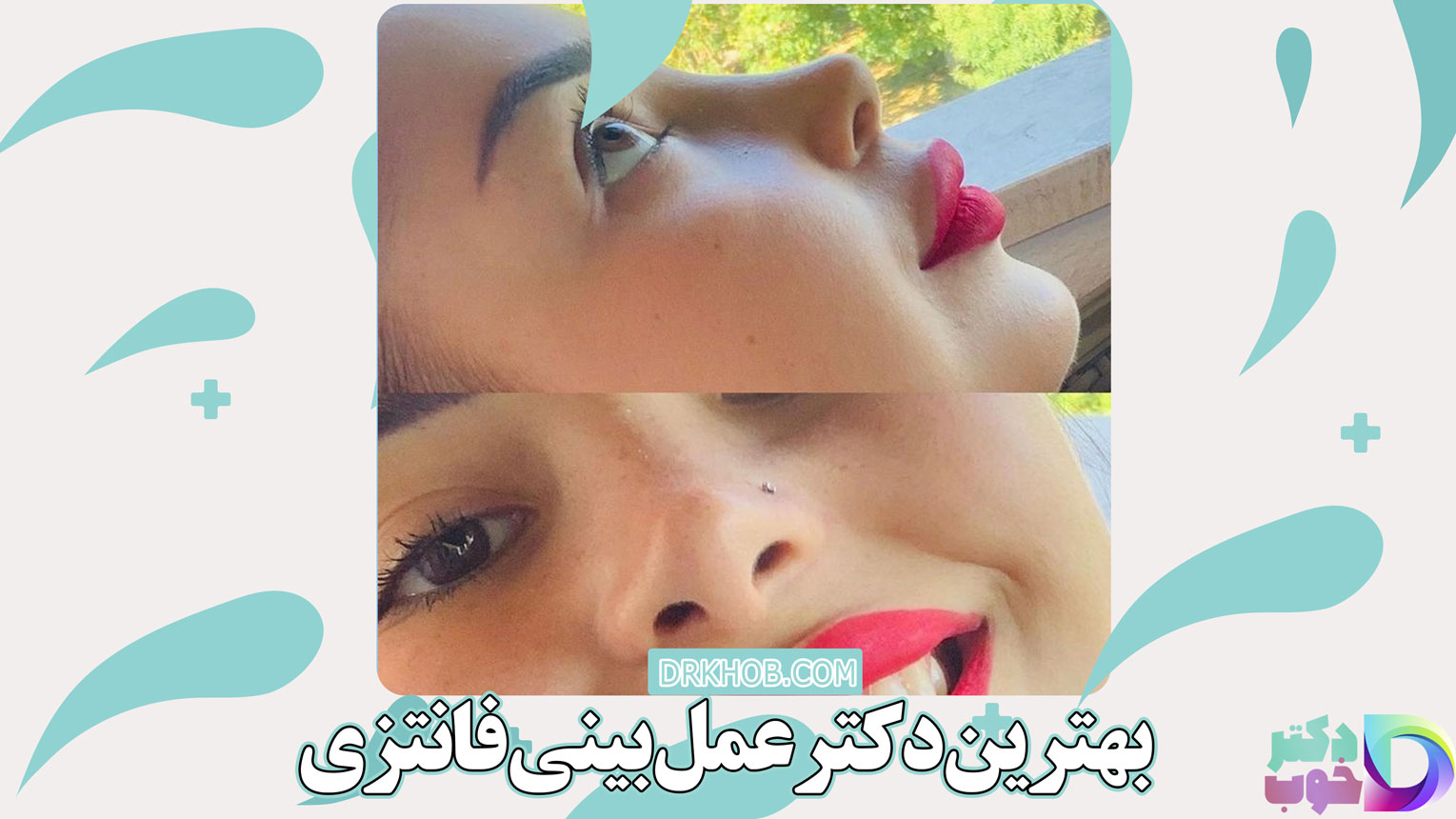 بهترین دکتر عمل بینی فانتزی