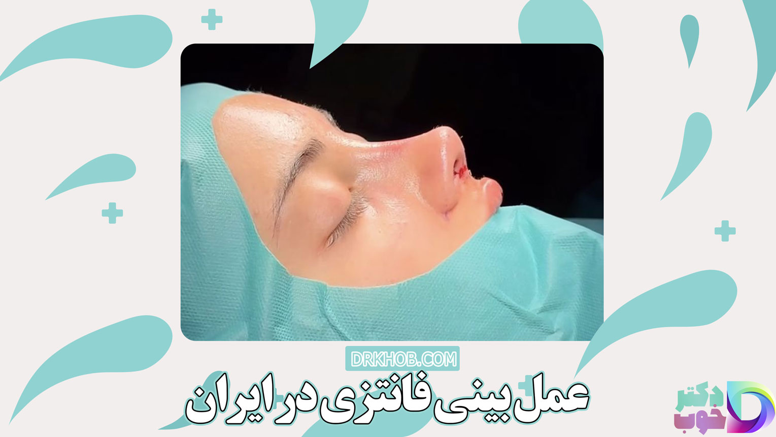 عمل بینی فانتزی در ایران