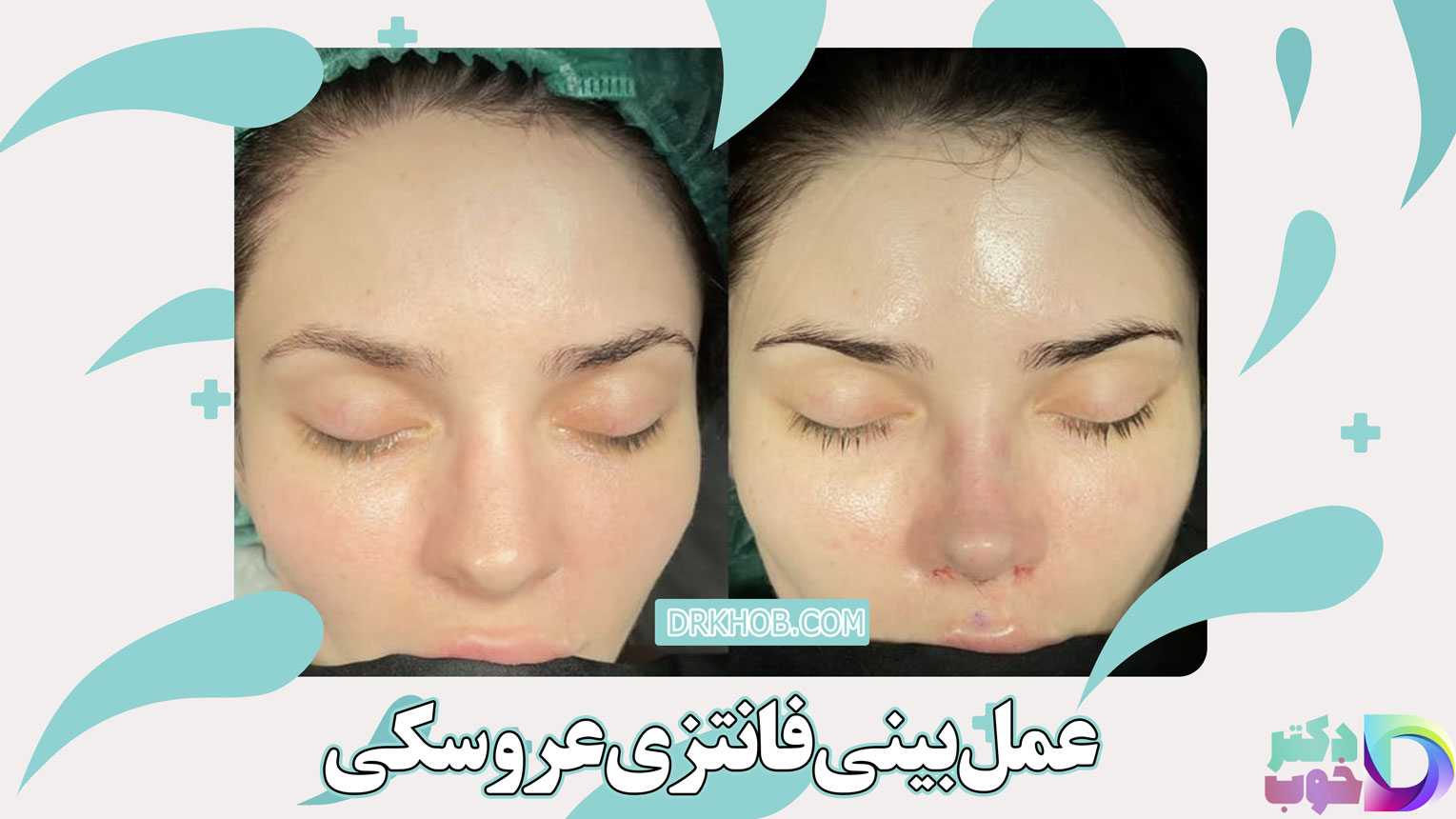 عمل بینی فانتزی عروسکی