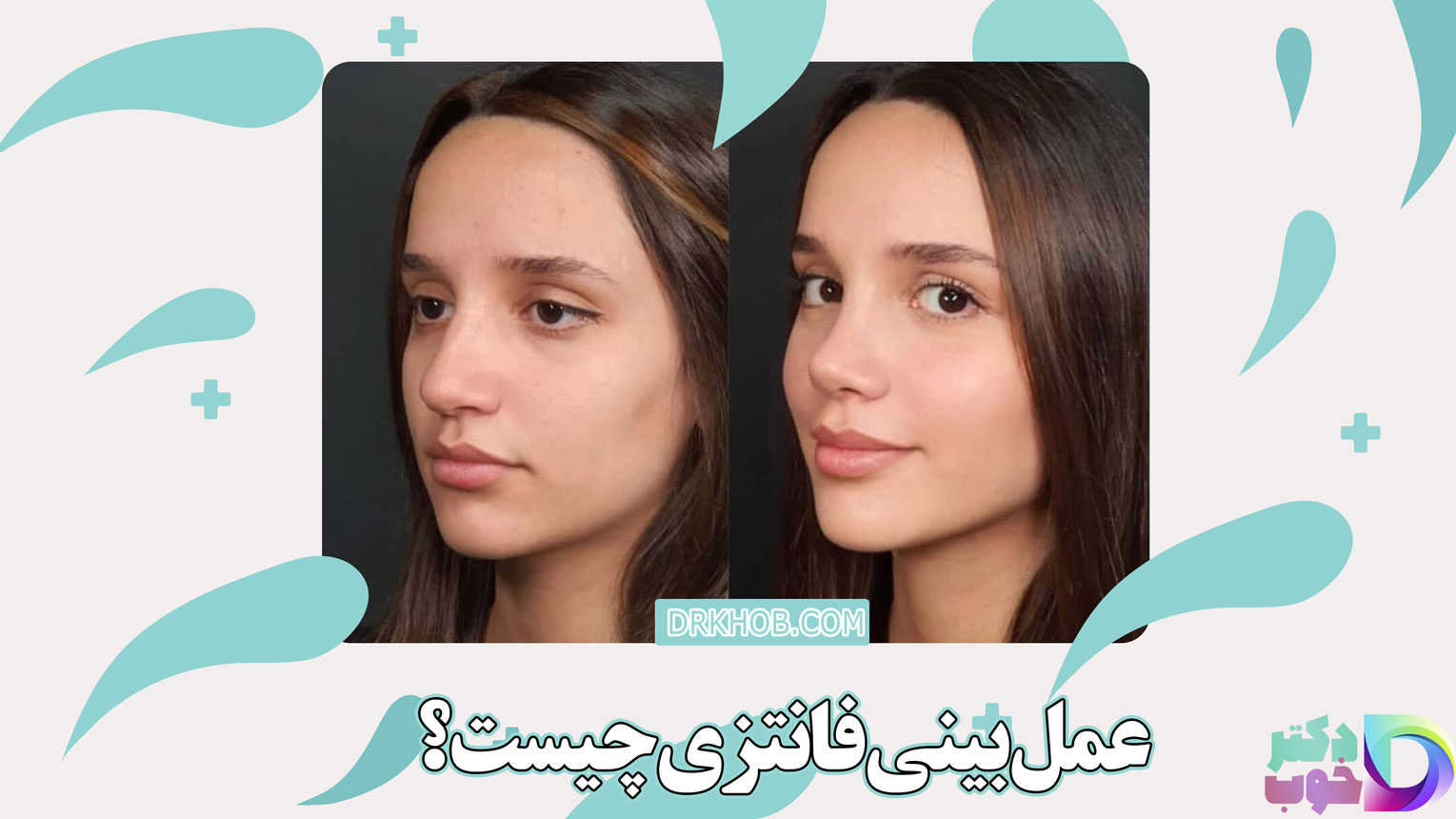 عمل بینی فانتزی چیست؟