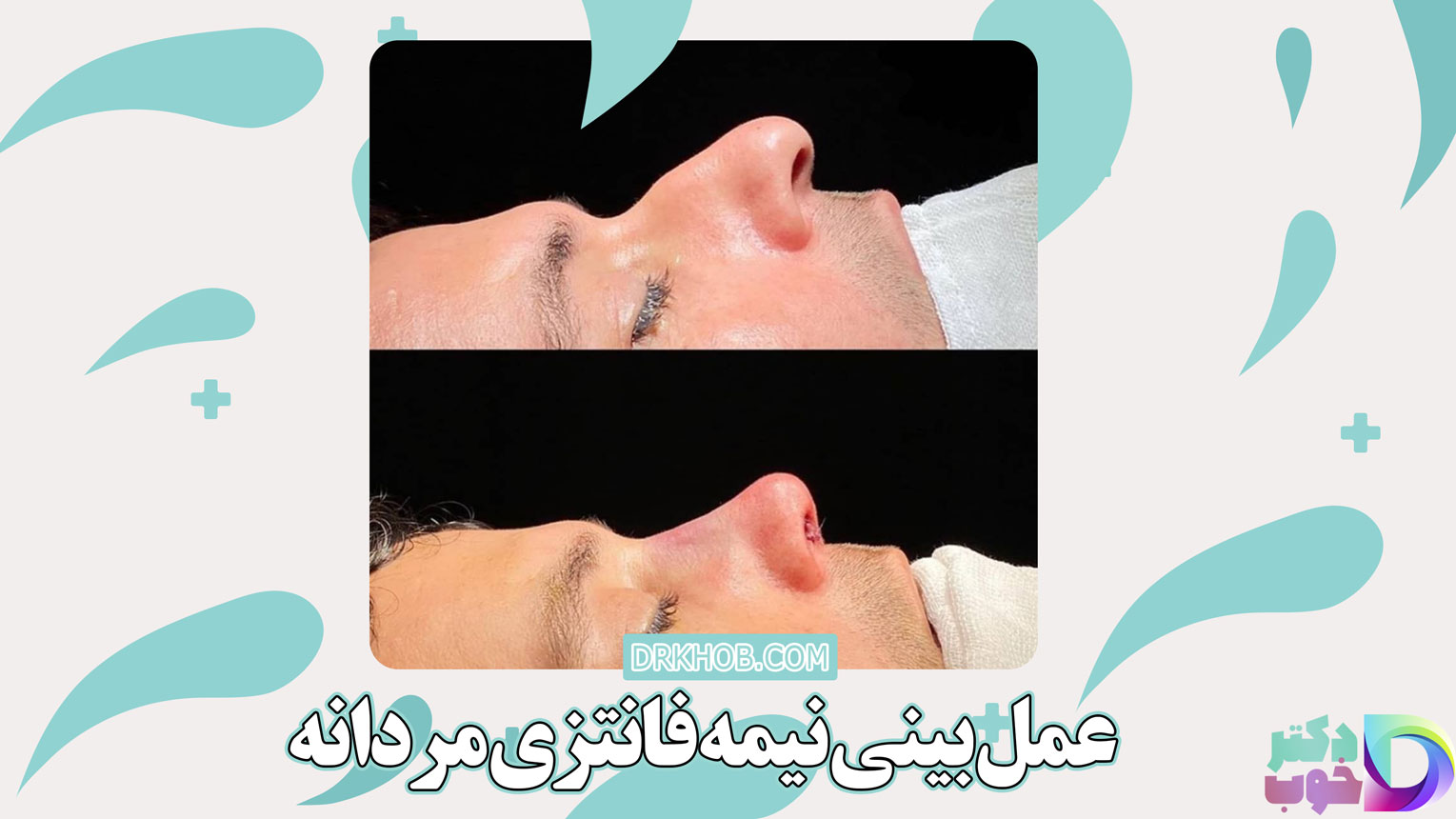 عمل بینی نیمه فانتزی مردانه