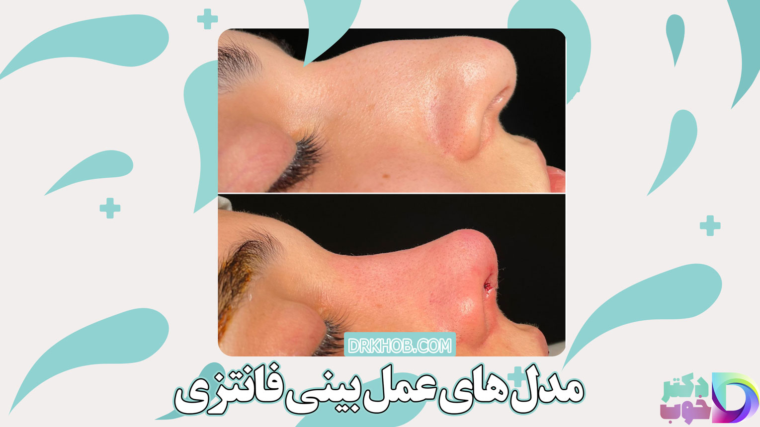 مدل های عمل بینی فانتزی