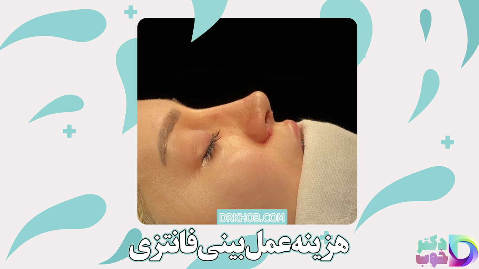هزینه عمل بینی فانتزی
